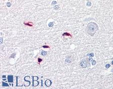 GLI / GLI1 Antibody - Anti-GLI1 antibody IHC of human brain, cortex. Immunohistochemistry of formalin-fixed, paraffin-embedded tissue after heat-induced antigen retrieval. Antibody concentration 5 ug/ml.