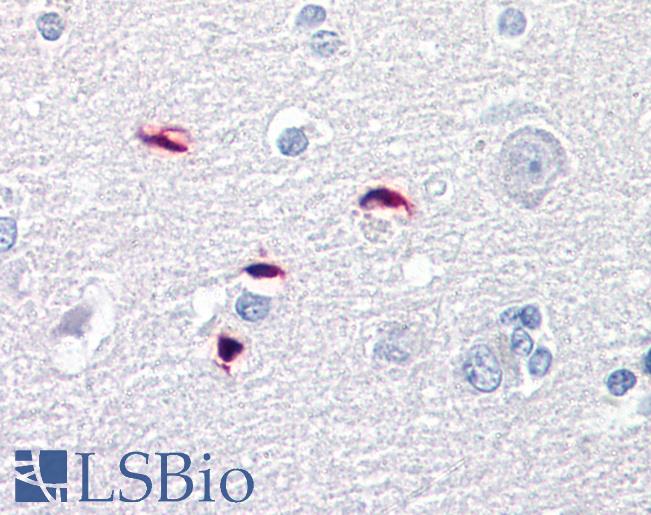 GLI / GLI1 Antibody - Anti-GLI1 antibody IHC of human brain, cortex. Immunohistochemistry of formalin-fixed, paraffin-embedded tissue after heat-induced antigen retrieval. Antibody concentration 5 ug/ml.