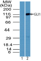 GLI / GLI1 Antibody - Western blot of GLI1 in human kidney lysate using 1) pre-immune sera at 1:5000 dilution and 2) GLI / GLI1 Antibody at1 ug/ml. Goat anti-rabbit Ig HRP secondary antibody, and PicoTect ECL substrate solution, were used for this test.