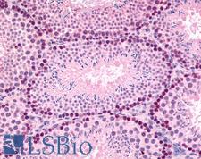 GLI2 Antibody - Anti-GLI2 antibody IHC of mouse, testis. Immunohistochemistry of formalin-fixed, paraffin-embedded tissue after heat-induced antigen retrieval. Antibody concentration 5 ug/ml.