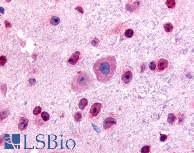 GLI2 Antibody - Anti-GLI2 antibody IHC of mouse, brain. Immunohistochemistry of formalin-fixed, paraffin-embedded tissue after heat-induced antigen retrieval. Antibody concentration 5 ug/ml.