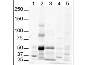 GLI3 Antibody - Anti-Gli-3 Antibody - Western Blot. Western blot of anti-Gli-3 antibody shows detection of multiple bands in human lung lysate believed to be Gli-3. Lanes contain 20 ug of whole cell lysates from 1 - human brain, 2 - human lung, 3 - human spleen, 4 - mouse brain and 5 - mouse lung. While no recognizable staining can be seen on mouse tissue, human lung shows what may be truncated Gli-3 (~80kD). This identity of the strong band at ~50 kD is unknown. After blocking, the membrane was probed with the primary antibody diluted to 1:500. For detection use HRP Gt-a-Rabbit IgG (LS-C60865). Detection of Gli-3 by western blot may be enhanced if nuclear extracts are used instead of whole cell lysates as the expression/abundance of Gli-3 is likely to be low. Furthermore, Gli3 expression is likely to be developmentally regulated and induced, making it difficult to detect in whole tissue homogenates.