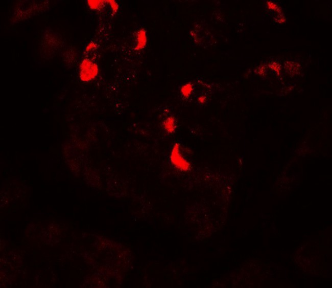 GLIPR1L1 Antibody - Immunofluorescence of GLIPR1L1 in human testis tissue with GLIPR1L1 antibody at 20 µg/mL.