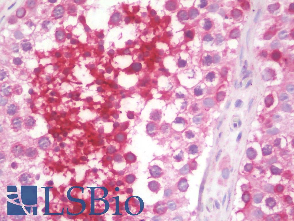 GLIPR1L1 Antibody - Anti-GLIPR1L1 antibody IHC staining of human testis. Immunohistochemistry of formalin-fixed, paraffin-embedded tissue after heat-induced antigen retrieval.