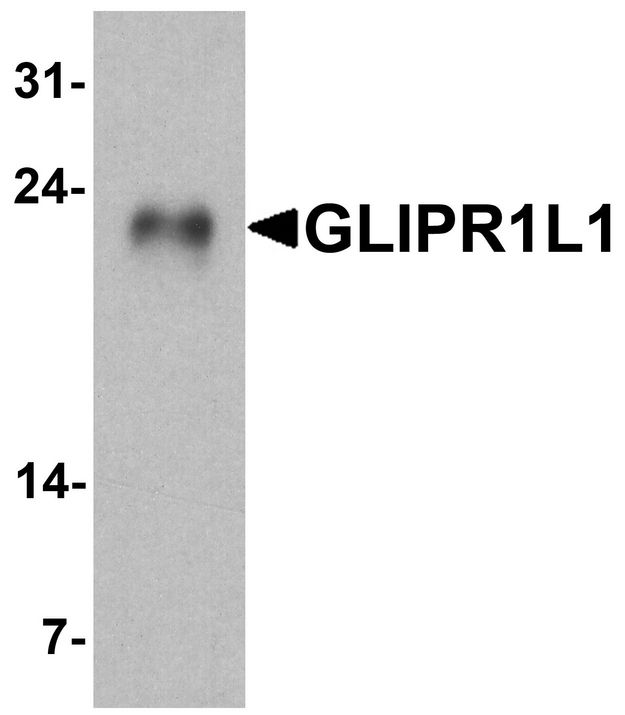 GLIPR1L1 Antibody - Western blot analysis of GLIPR1L1 in human testis tissue lysate with GLIPR1L1 antibody at 1 ug/ml.