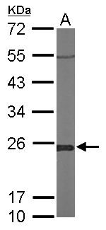 GLO1 / Glyoxalase I Antibody - Sample (50 ug of whole cell lysate). A: Mouse brain. 12% SDS PAGE. GLO1 / Glyoxalase I antibody diluted at 1:1000.