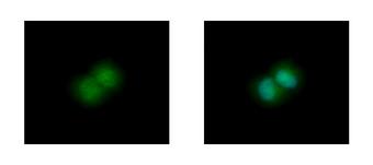GLO1 / Glyoxalase I Antibody - Glyoxalase I antibody [N1C3] detects GLO1 protein at cytoplasm and nucleus by immunofluorescent analysis. HepG2 cells were fixed in 4% paraformaldehyde at RT for 15 min. GLO1 protein stained by Glyoxalase I antibody [N1C3] diluted at 1:500. 