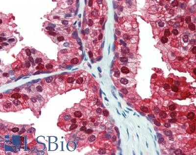 GLO1 / Glyoxalase I Antibody - Human Prostate: Formalin-Fixed, Paraffin-Embedded (FFPE)