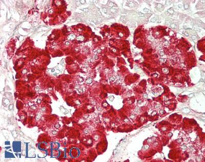 GLP1R / GLP-1 Receptor Antibody - Human Pancreas: Formalin-Fixed, Paraffin-Embedded (FFPE)