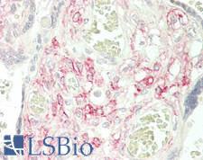 GLP1R / GLP-1 Receptor Antibody - Human Placenta: Formalin-Fixed, Paraffin-Embedded (FFPE)