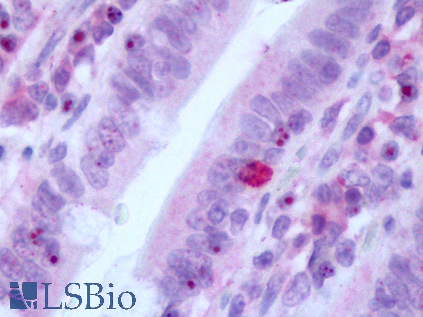 GLP2R Antibody - Human Small Intestine: Formalin-Fixed, Paraffin-Embedded (FFPE)