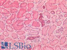 GLS / Glutaminase Antibody - Human Kidney: Formalin-Fixed, Paraffin-Embedded (FFPE)