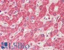 GLS2 / Glutaminase 2 Antibody - Human Liver: Formalin-Fixed, Paraffin-Embedded (FFPE)