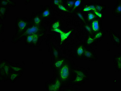 GLS2 / Glutaminase 2 Antibody - Immunofluorescence staining of HepG2 cells with GLS2 Antibody at 1:133, counter-stained with DAPI. The cells were fixed in 4% formaldehyde, permeabilized using 0.2% Triton X-100 and blocked in 10% normal Goat Serum. The cells were then incubated with the antibody overnight at 4°C. The secondary antibody was Alexa Fluor 488-congugated AffiniPure Goat Anti-Rabbit IgG(H+L).