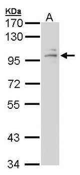 Glucocorticoid Receptor Beta Antibody - Sample (30 ug of whole cell lysate). A: A431 . 7.5% SDS PAGE. GR / Glucocorticoid Receptor antibody diluted at 1:1000.