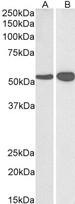 GLUD1/Glutamate Dehydrogenase Antibody - Goat Anti-Glutamate Dehydrogenase Antibody (0.03?/ml) staining of Human (A) and Mouse (B) Brain lysate (35? protein in RIPA buffer). Primary incubation was 1 hour. Detected by chemiluminescence.