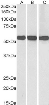 GLUD1/Glutamate Dehydrogenase Antibody - Goat Anti-Glutamate Dehydrogenase Antibody (0.01?/ml) staining of Human (A), Mouse (B) and Rat (C) Liver lysate (35? protein in RIPA buffer). Primary incubation was 1 hour. Detected by chemiluminescence.