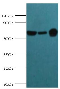 GLUD2 Antibody - Western blot. All lanes: Glutamate dehydrogenase 2, mitochondrial antibody at 2 ug/ml. Lane 1: mouse brain tissue. Lane 2: 293T whole cell lysate. Lane 2: rat brain tissue. secondary Goat polyclonal to rabbit at 1:10000 dilution. Predicted band size: 61 kDa. Observed band size: 61 kDa.