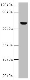 GLUD2 Antibody - Western blot All lanes: GLUD2 antibody at 2µg/ml + 293T whole cell lysate Secondary Goat polyclonal to rabbit IgG at 1/10000 dilution Predicted band size: 61 kDa Observed band size: 61 kDa