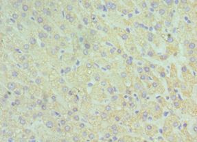 GLUD2 Antibody - Immunohistochemistry of paraffin-embedded human liver using antibody 1:100 dilution.