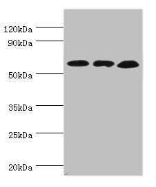 GLUD2 Antibody - Western blot All lanes: Glutamate dehydrogenase 2, mitochondrial antibody at 4µg/ml Lane 1: Mouse brain tissue Lane 2: 293T whole cell lysate Lane 3: Rat brain tissue Secondary Goat polyclonal to rabbit IgG at 1/10000 dilution Predicted band size: 61 kDa Observed band size: 61 kDa