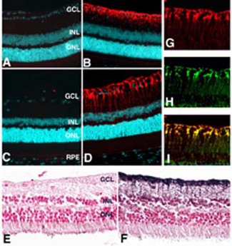 GLUL / Glutamine Synthetase Antibody - Localization of glutamine synthase in the retina. Paraffin sections of mouse (A, B), rat (C, D, G-I), or human (E, F) retina fixed in 4% paraformaldehyde were reacted with anti-glutamine synthase (red fluorescence staining in B, D, G, I, and brown immuno-peroxidase reaction [using ABC kit and visualization with DAB product in F]. Nuclei in some immunofluorescence experiments (A-D) were stained with DAPI (shown in cyan), and with nuclear fast red in E and F. On inspection at low magnification, an.
