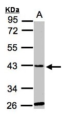 GLYATL1 Antibody - Sample (30 ug whole cell lysate). A: Hep G2 . 10% SDS PAGE. GLYATL1 antibody diluted at 1:1000