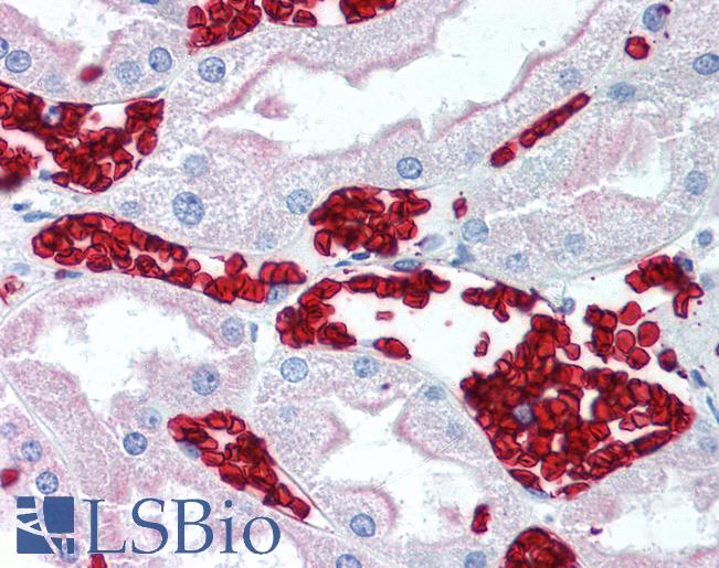 Glycophorin A+B Antibody - Anti-GYPA / Glycophorin A antibody IHC of human kidney, red blood cells. Immunohistochemistry of formalin-fixed, paraffin-embedded tissue after heat-induced antigen retrieval. Antibody dilution 1:50.