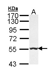 GLYCTK / Glycerate Kinase Antibody - Sample (30 ug of whole cell lysate). A: Hep G2 . 7.5% SDS PAGE. GLYCTK / Glycerate Kinase antibody diluted at 1:1000.