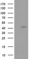 GMDS / GMD Antibody - HEK293T cells were transfected with the pCMV6-ENTRY control (Left lane) or pCMV6-ENTRY GMDS (Right lane) cDNA for 48 hrs and lysed. Equivalent amounts of cell lysates (5 ug per lane) were separated by SDS-PAGE and immunoblotted with anti-GMDS.