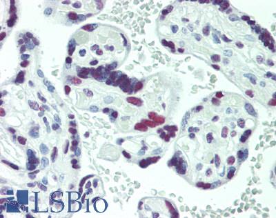 GMEB1 Antibody - Human Placenta: Formalin-Fixed, Paraffin-Embedded (FFPE)