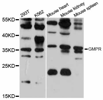 GMPR1 / GMPR Antibody - Western blot analysis of extracts of various cell lines, using GMPR antibody at 1:1000 dilution. The secondary antibody used was an HRP Goat Anti-Rabbit IgG (H+L) at 1:10000 dilution. Lysates were loaded 25ug per lane and 3% nonfat dry milk in TBST was used for blocking. An ECL Kit was used for detection and the exposure time was 30s.