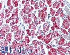 GMPS / GMP Synthase Antibody - Anti-GMPS antibody IHC of human heart. Immunohistochemistry of formalin-fixed, paraffin-embedded tissue after heat-induced antigen retrieval. Antibody concentration 5 ug/ml.