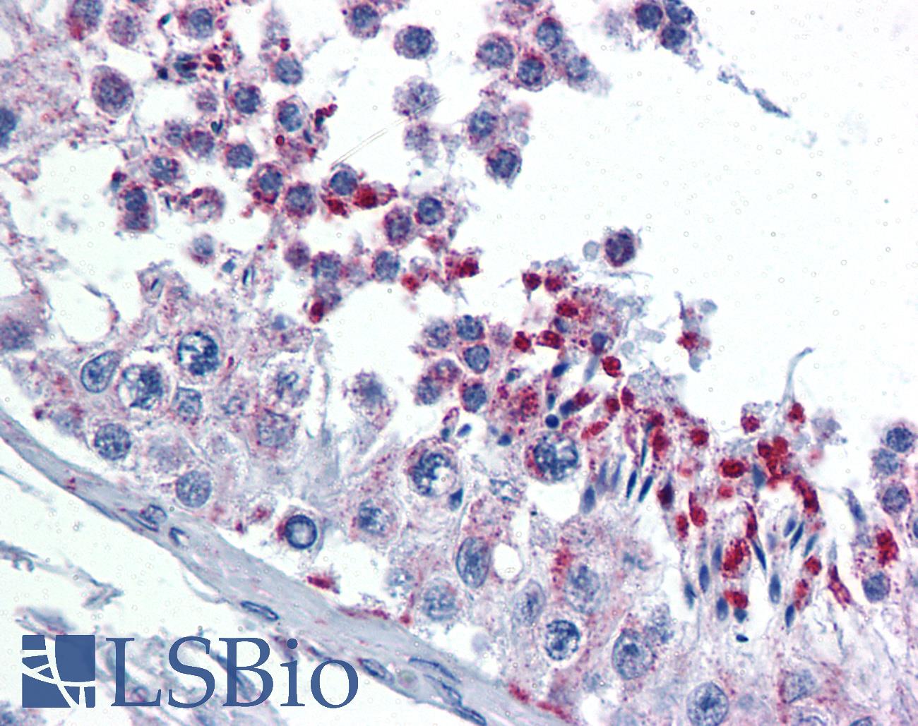 GMPS / GMP Synthase Antibody - Anti-GMPS antibody IHC of human testis. Immunohistochemistry of formalin-fixed, paraffin-embedded tissue after heat-induced antigen retrieval. Antibody concentration 5 ug/ml.