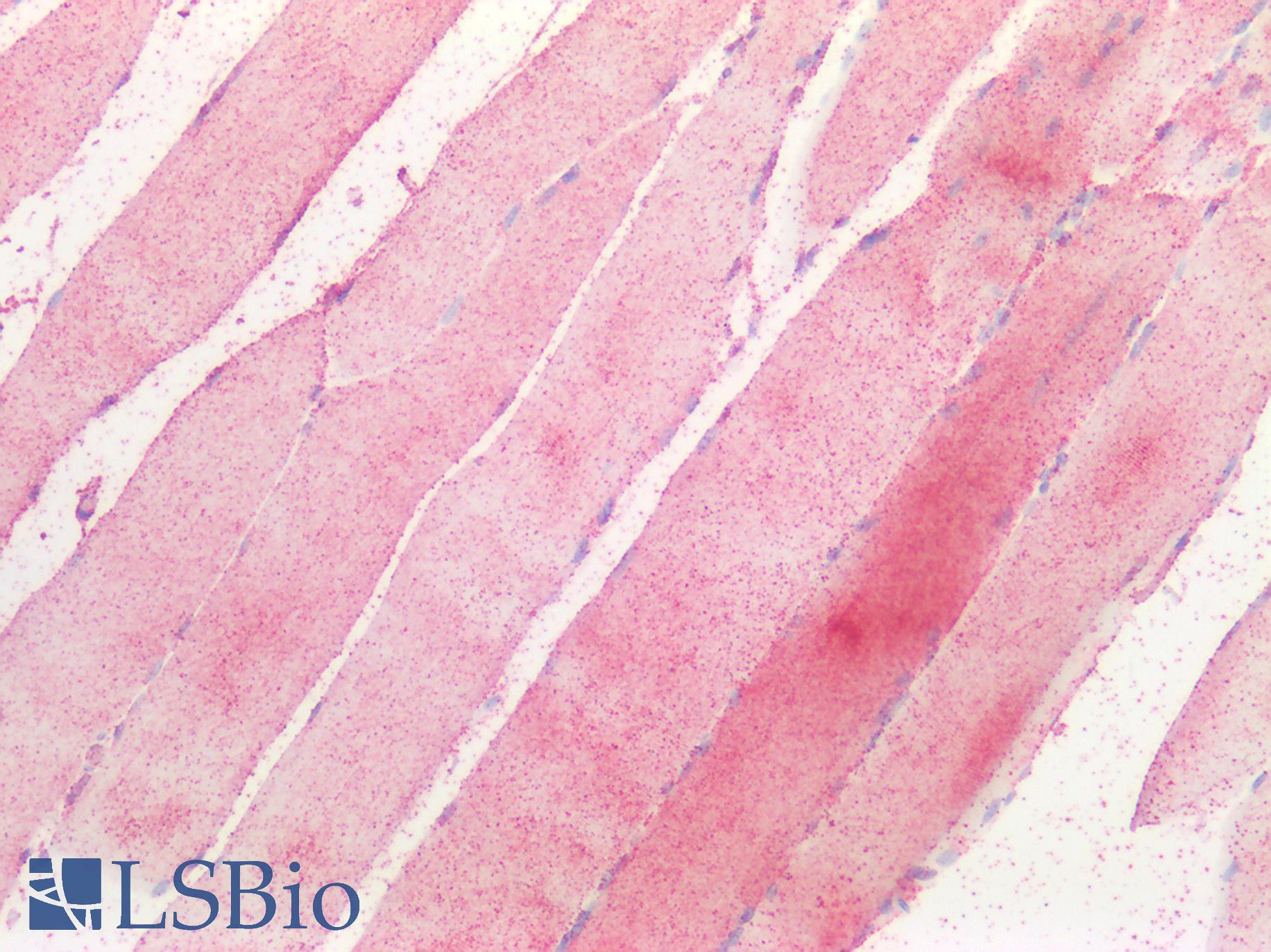 GNA12 Antibody - Human Skeletal Muscle: Formalin-Fixed, Paraffin-Embedded (FFPE)