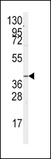 GNA12 Antibody - Western blot of anti-GNA12 Antibody (S67) in A2058 cell line lysates (35 ug/lane). GNA12(arrow) was detected using the purified antibody.