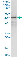GNAI1 / Gi Antibody - GNAI1 monoclonal antibody, clone 2B8-2A5. Western blot of GNAI1 expression in human liver.