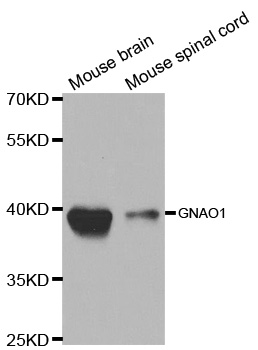 GNAO1 Antibody - Western blot analysis of extracts of various cell lines, using GNAO1 antibody.