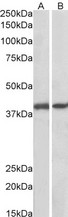 GNAQ Antibody - Goat Anti-GNAQ / ALPHA-q (aa162-175) Antibody (0.1µg/ml) staining of Pig Colon (A) and Pig Spleen (B) lysates (35µg protein in RIPA buffer). Primary incubation was 1 hour. Detected by chemiluminescencence.