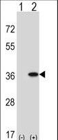 GNAQ Antibody - Western blot of GNAQ (arrow) using rabbit polyclonal GNAQ Antibody. 293 cell lysates (2 ug/lane) either nontransfected (Lane 1) or transiently transfected (Lane 2) with the GNAQ gene.