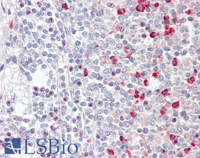 GNAQ Antibody - Anti-GNAQ antibody IHC staining of human spleen. Immunohistochemistry of formalin-fixed, paraffin-embedded tissue after heat-induced antigen retrieval.