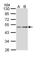 GNAS Antibody - Sample (30 ug of whole cell lysate). A: Hep G2. B: Raji. 10% SDS PAGE. GNAS antibody diluted at 1:1000. 
