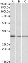 GNB2L1 / RACK1 Antibody - Goat Anti-GNB2L1 Antibody (0.1µg/ml) staining of Human Lymph Node (A), Mouse Spleen (B) and Rat Spleen (C) lysates (35µg protein in RIPA buffer). Detected by chemiluminescencence.
