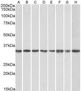 GNB2L1 / RACK1 Antibody - Goat Anti-GNB2L1 Antibody (0.1µg/ml) staining of NIH3T3 (A), HeK293 (B), HeLa (C, A431(D), A549 (E), MCF7 (F), Jurkat (G), K562 (H) lysates (35µg protein in RIPA buffer). Detected by chemiluminescencence.