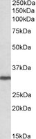 GNB2L1 / RACK1 Antibody - GNB2L1 antibody (0.1 ug/ml) staining of Human Lymph Node lysate (35 ug protein/ml in RIPA buffer). Primary incubation was 1 hour. Detected by chemiluminescence.