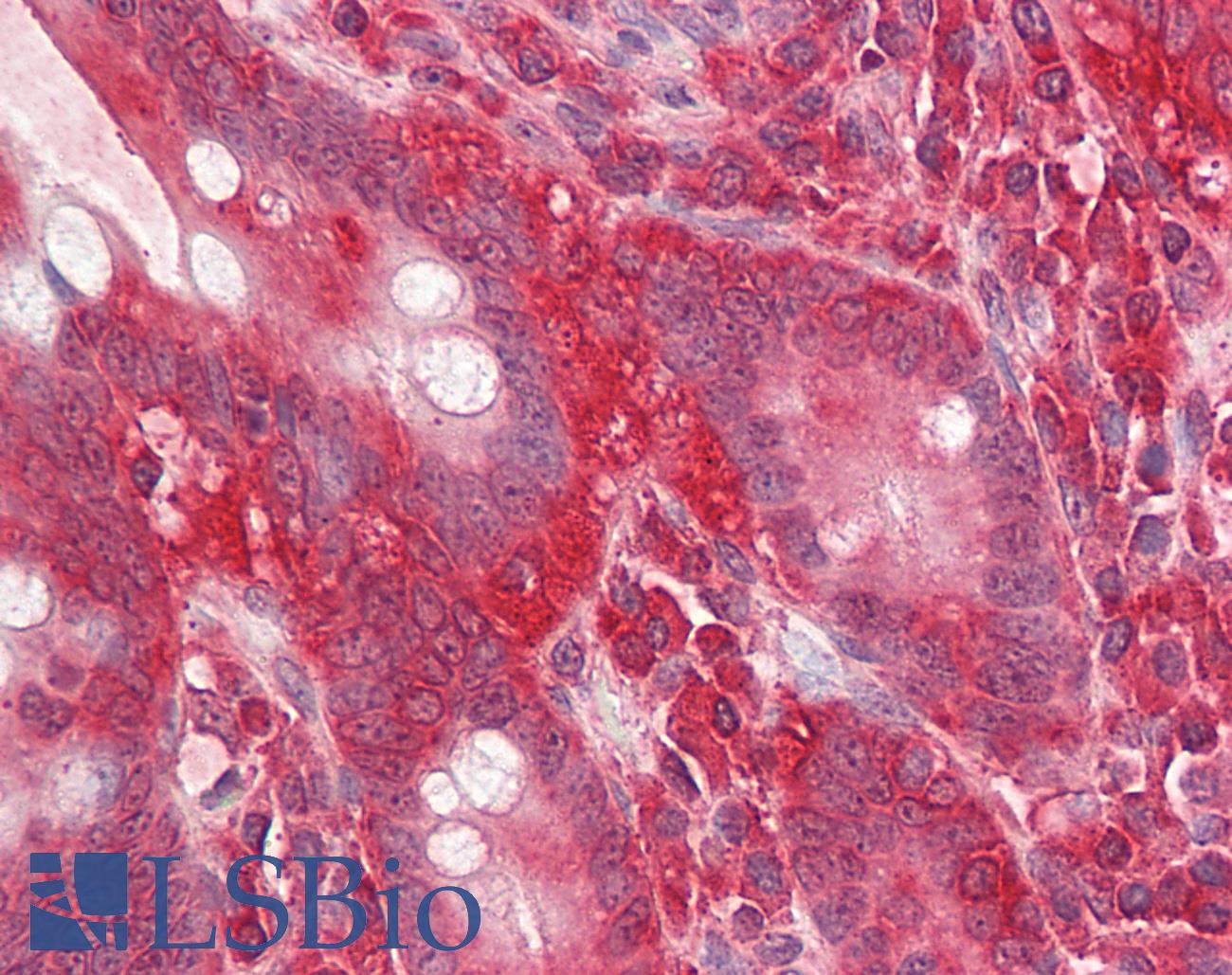 GNB2L1 / RACK1 Antibody - Anti-GNB2L1 / RACK1 antibody IHC of human small intestine. Immunohistochemistry of formalin-fixed, paraffin-embedded tissue after heat-induced antigen retrieval. Antibody dilution 3.75 ug/ml.