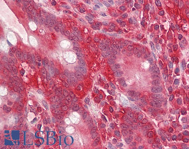 GNB2L1 / RACK1 Antibody - Anti-GNB2L1 / RACK1 antibody IHC of human small intestine. Immunohistochemistry of formalin-fixed, paraffin-embedded tissue after heat-induced antigen retrieval. Antibody dilution 3.75 ug/ml.