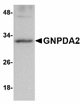 GNPDA2 Antibody - Western blot of GNPDA2 in human kidney lysate with GNPDA2 antibody at 1 ug/ml. 