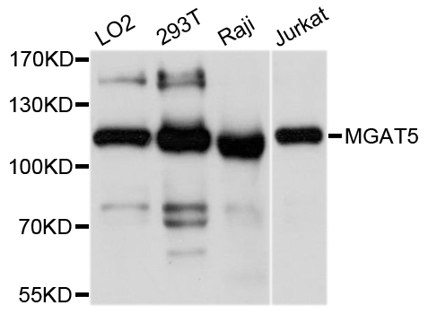 GNT-V / MGAT5 Antibody - Western blot analysis of extracts of various cell lines, using MGAT5 antibody at 1:1000 dilution. The secondary antibody used was an HRP Goat Anti-Rabbit IgG (H+L) at 1:10000 dilution. Lysates were loaded 25ug per lane and 3% nonfat dry milk in TBST was used for blocking. An ECL Kit was used for detection and the exposure time was 1s.