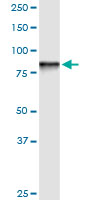 GOK / STIM1 Antibody - STIM1 monoclonal antibody clone 5A2. Western blot of STIM1 expression in human liver.